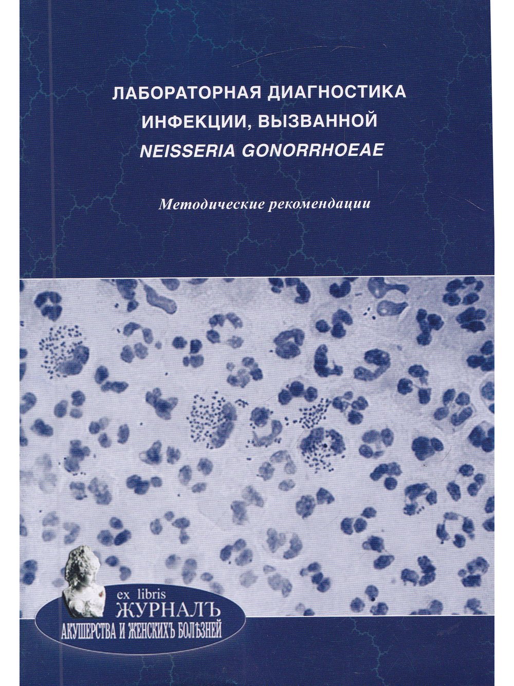 Лабораторная диагностика инфекции, вызванной Neisseria gonorrhoeae: методические рекомендации