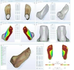 Ортопедический 3D сканер ScanPod3D XPOD-SS