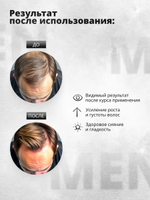 Набор 2 в 1 для мужчин - Никотиновый шампунь 500 мл, никотиновая кислота 150 мл
