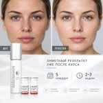 Luminescence Kit