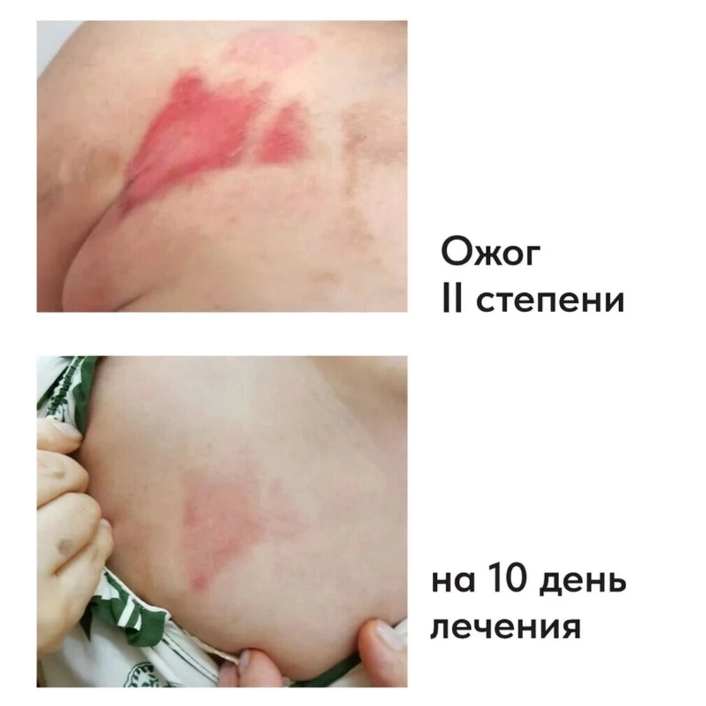 Gana Patch | Ранозаживляющая повязка