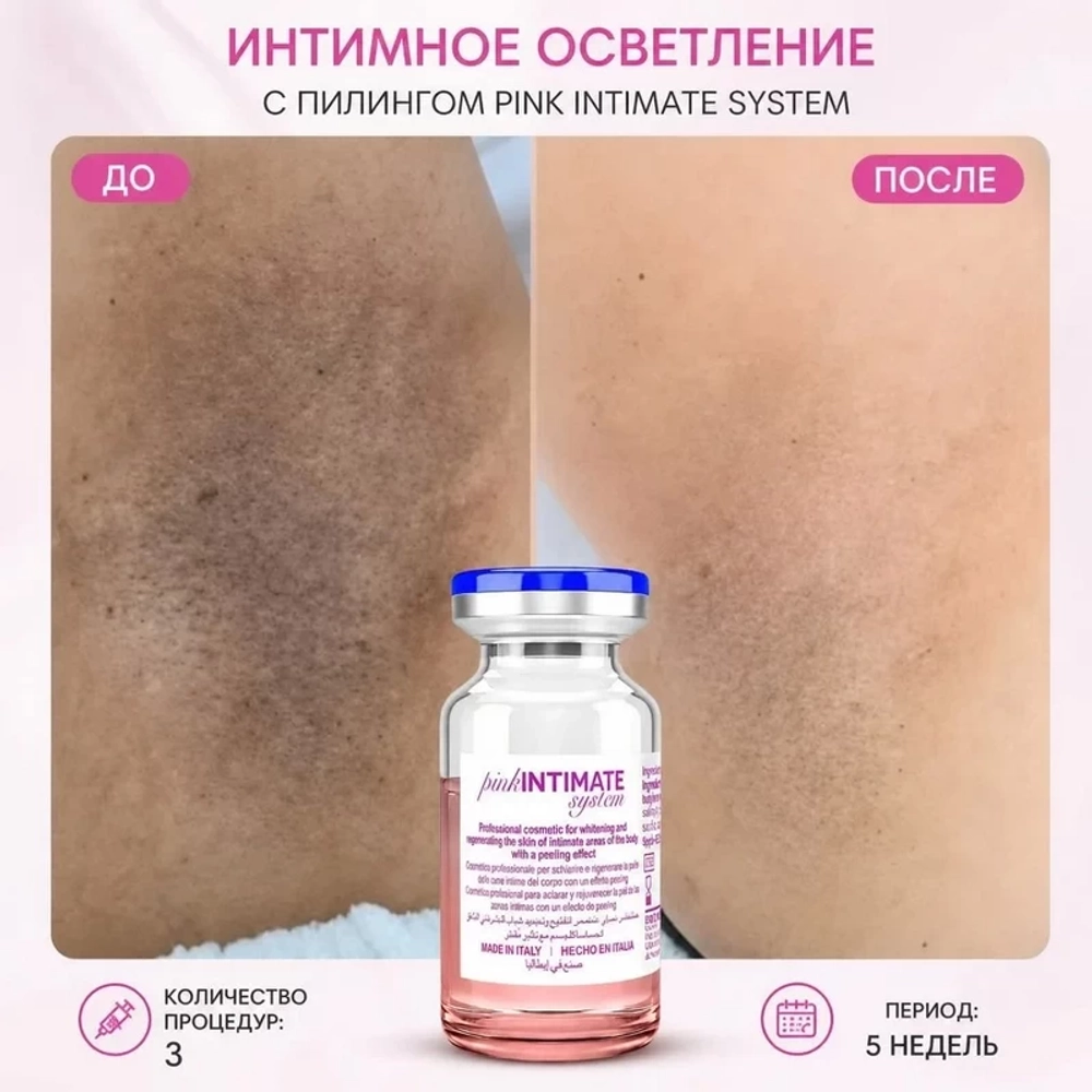 Pink Intimate System