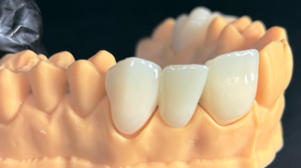 Фотополимерная смола SMILL C&B resin A2 1000г