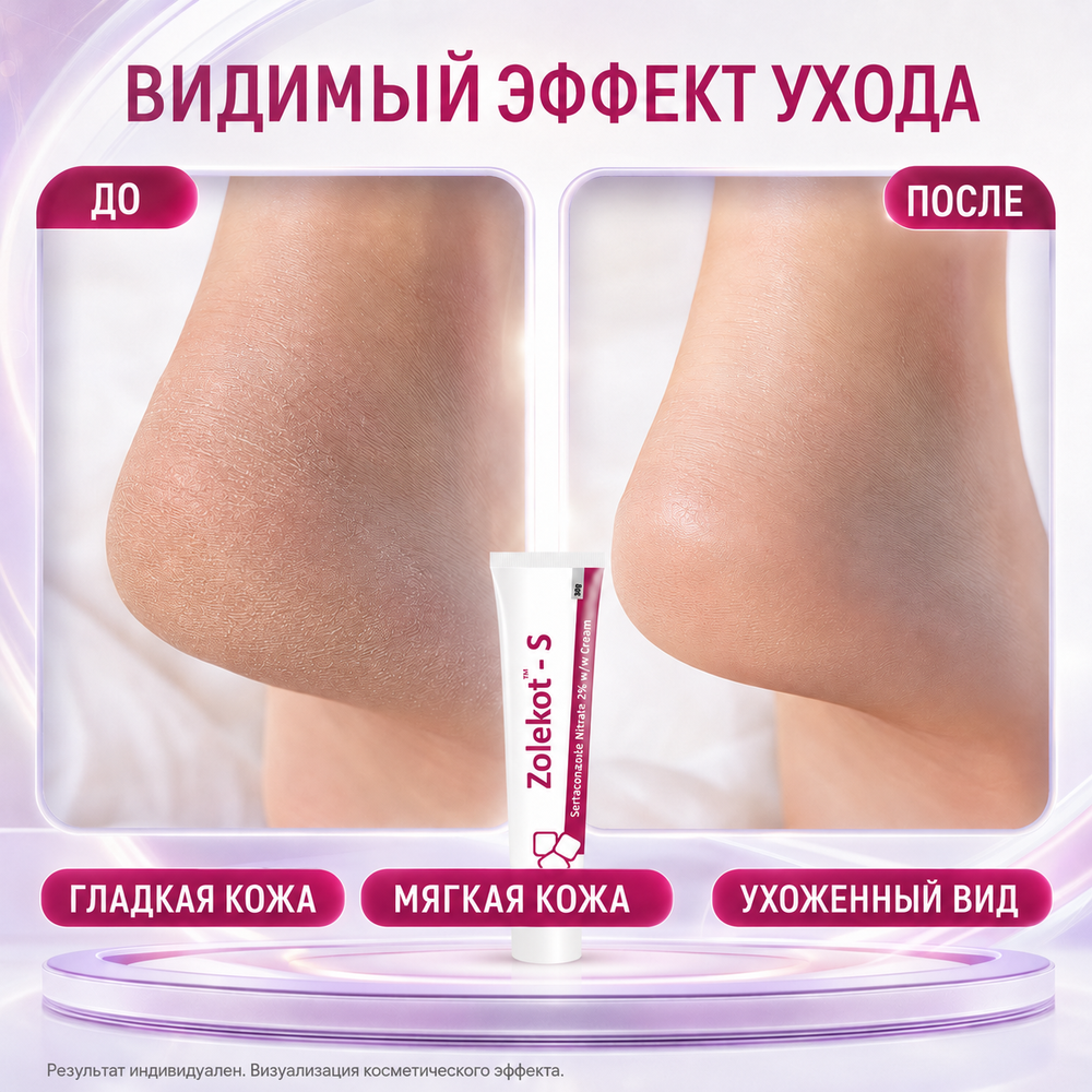 ЗОЛЕКОТ-С кремі