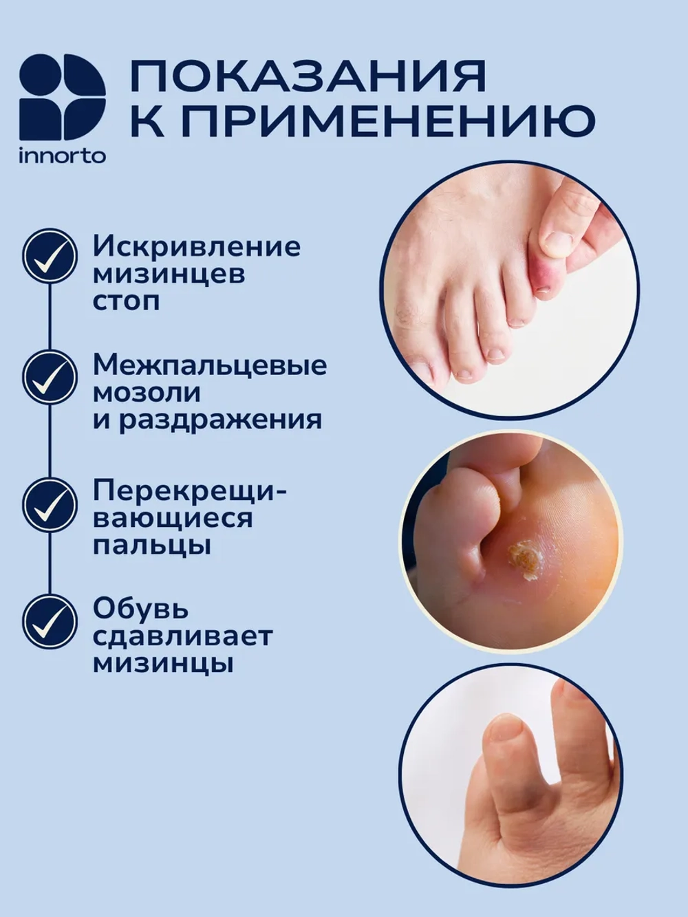 Разделитель для мизинца ног