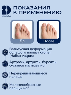 Разделитель пальцев ног ортопедический