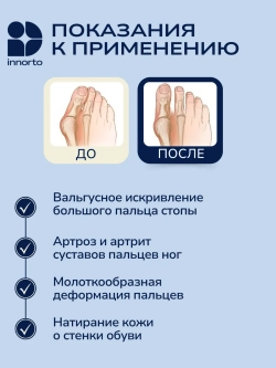 Бурсопротектор для большого пальца