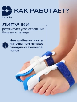Вальгусный корректор большого пальца