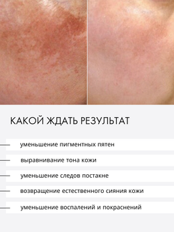 СЫВОРОТКА ОТ ГИПЕРПИГМЕНТАЦИИ LAURA ZACKARYA — 5% АЛЬФА-АРБУТИН И 3% ВИТАМИН C