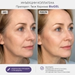 Твоя Харизма BioGEL | Коллаген + Экзосомы