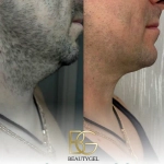Slim BeautyGel