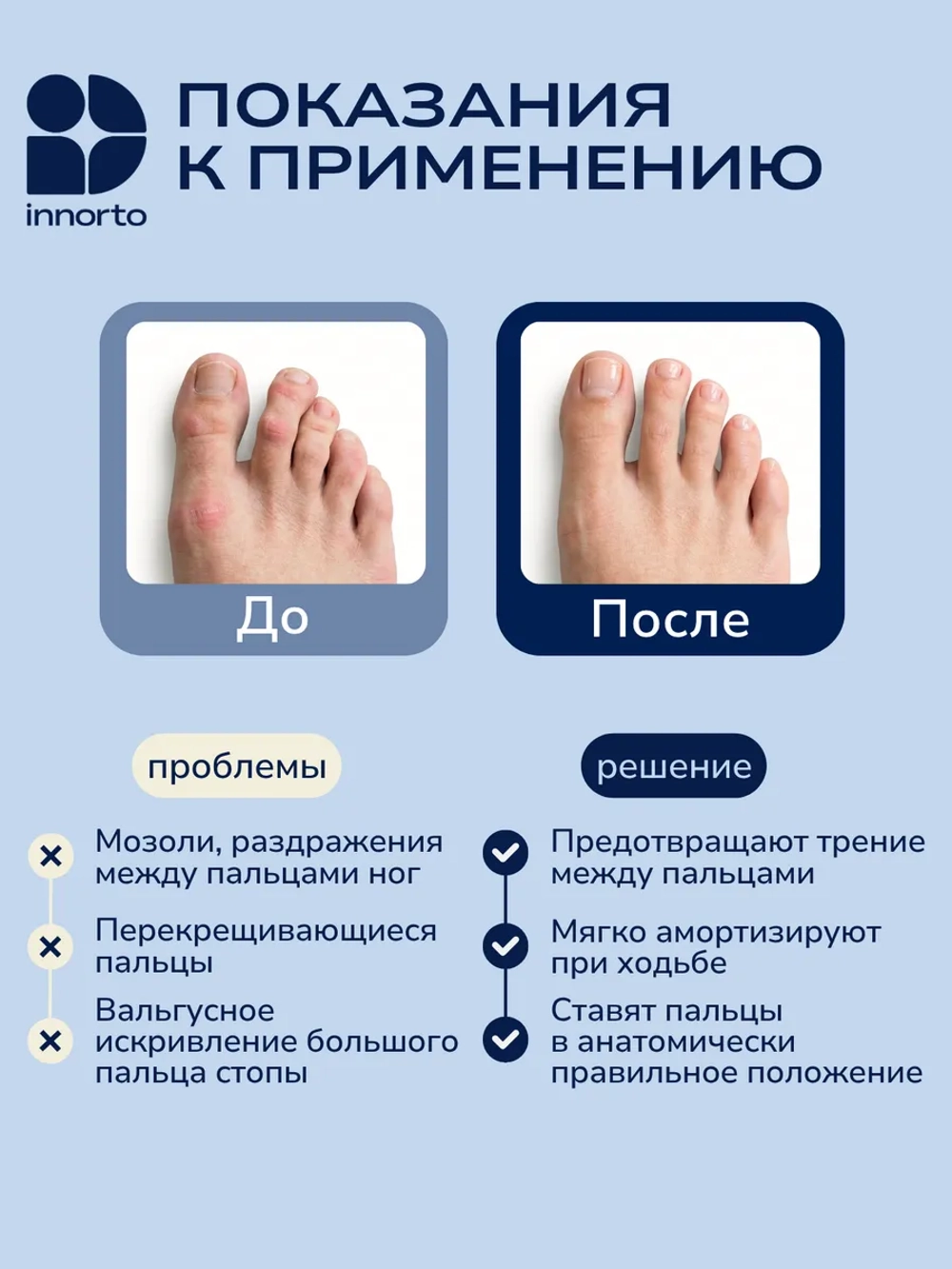 Разделители большого пальца ног