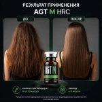 Hair Restoring Complex AGT М