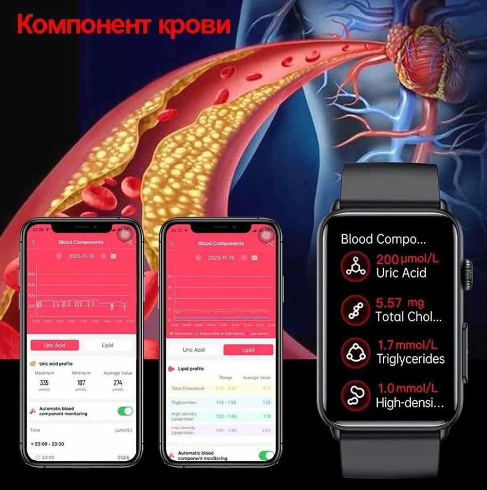 Смарт часы Глюкометр XRide ET602 - Bluetooth-звонки, температура тела, сахар в крови, ЭКГ, давление