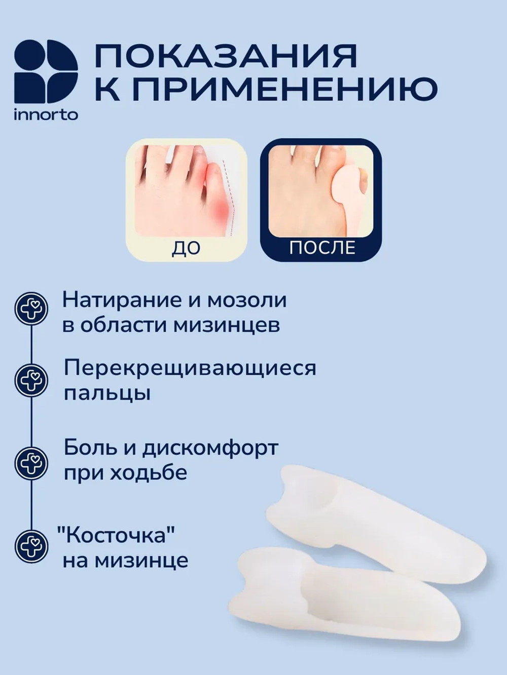 Бурсопротектор, разделители мизинца для ног
