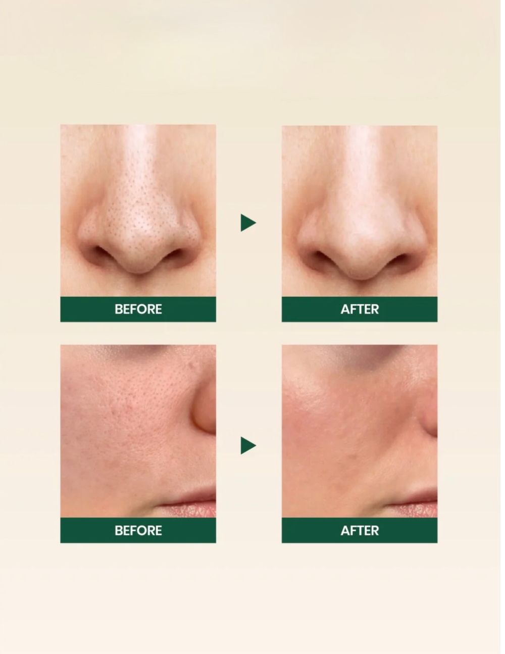 K-SECRET Пенка для умывания Seoul 1988 Cleansing Foam: Pine Cica 1% + Probiotics (150 мл)
