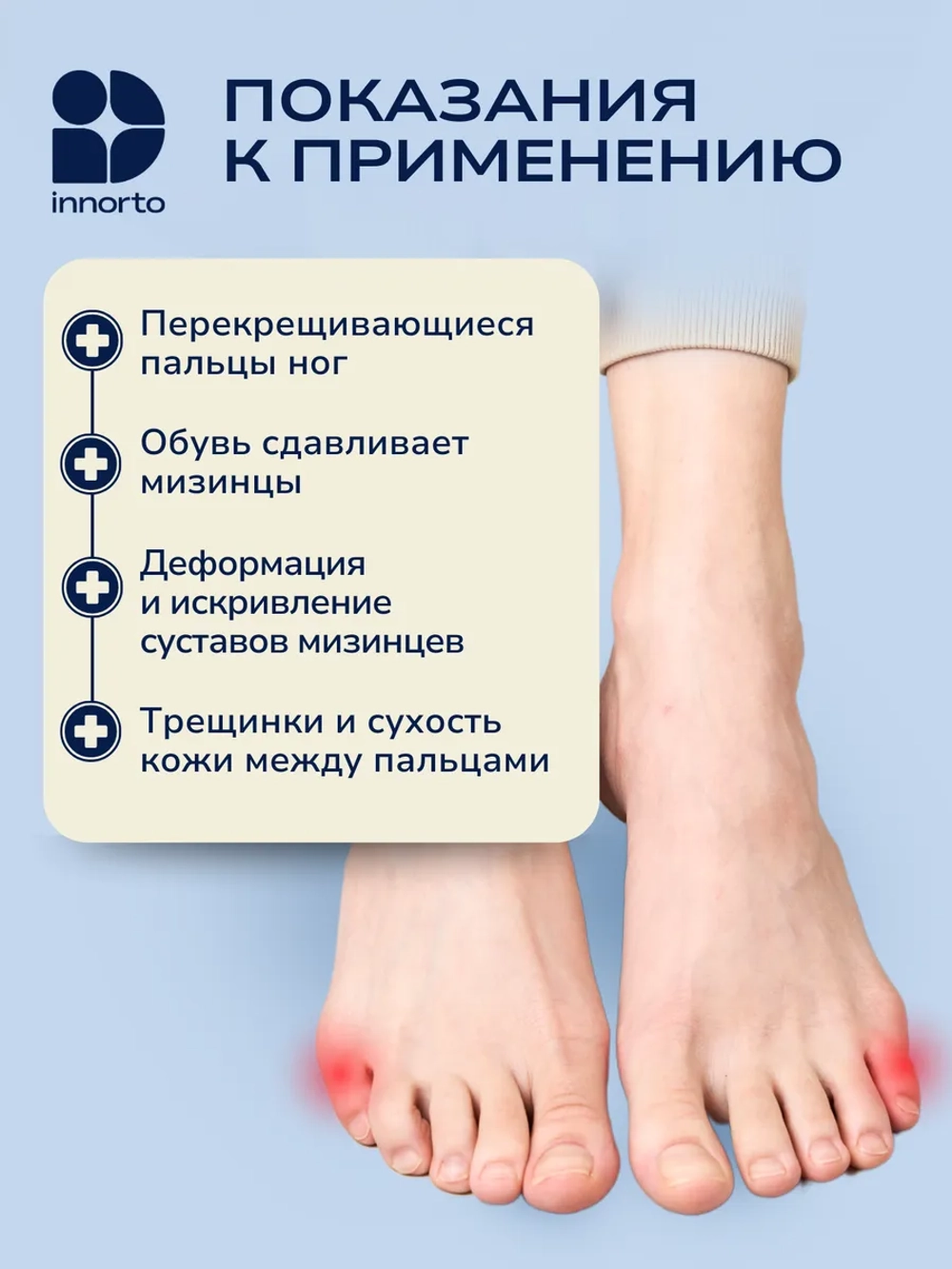 Бурсопротектор мизинца с разделителем