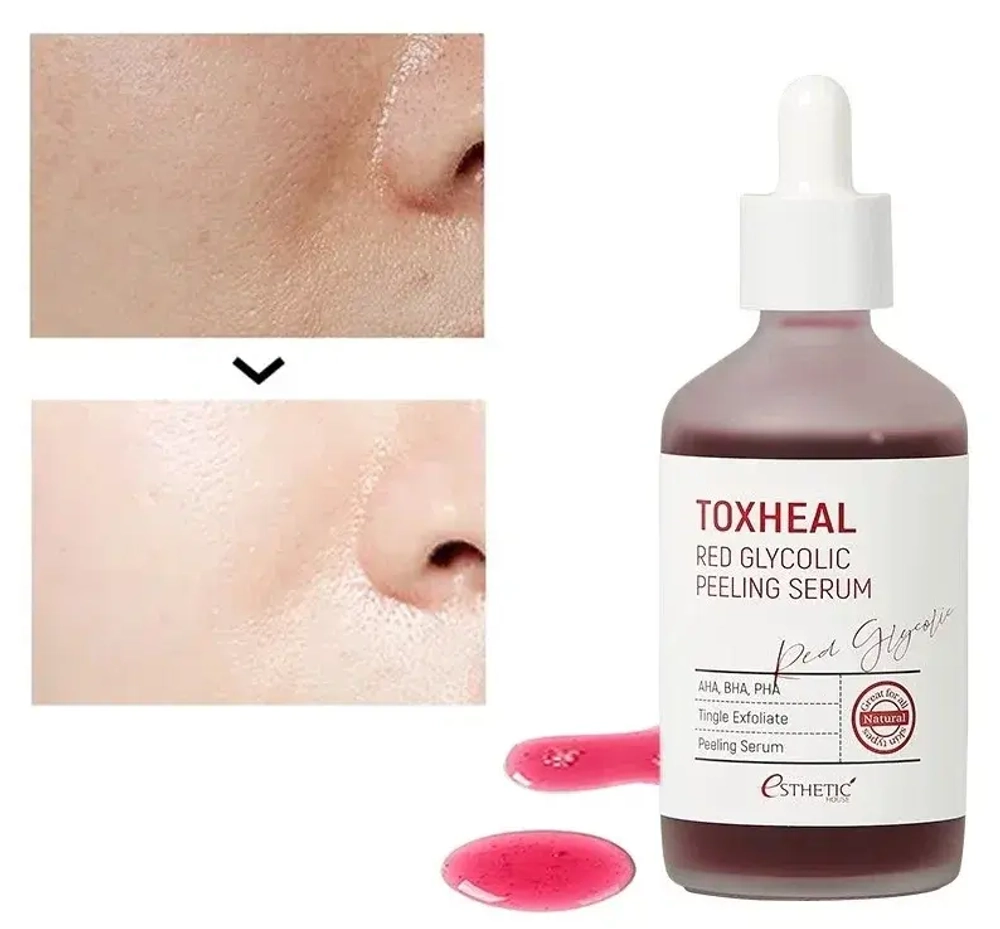 Красная гликолевая пилинг-сыворотка Esthetic House Toxheal Red Glycolic Peeling Serum, 100мл