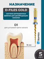 Машинные эндодонтические инструменты STEA D-Files Gold для перелечивания, 16мм, размер D1
