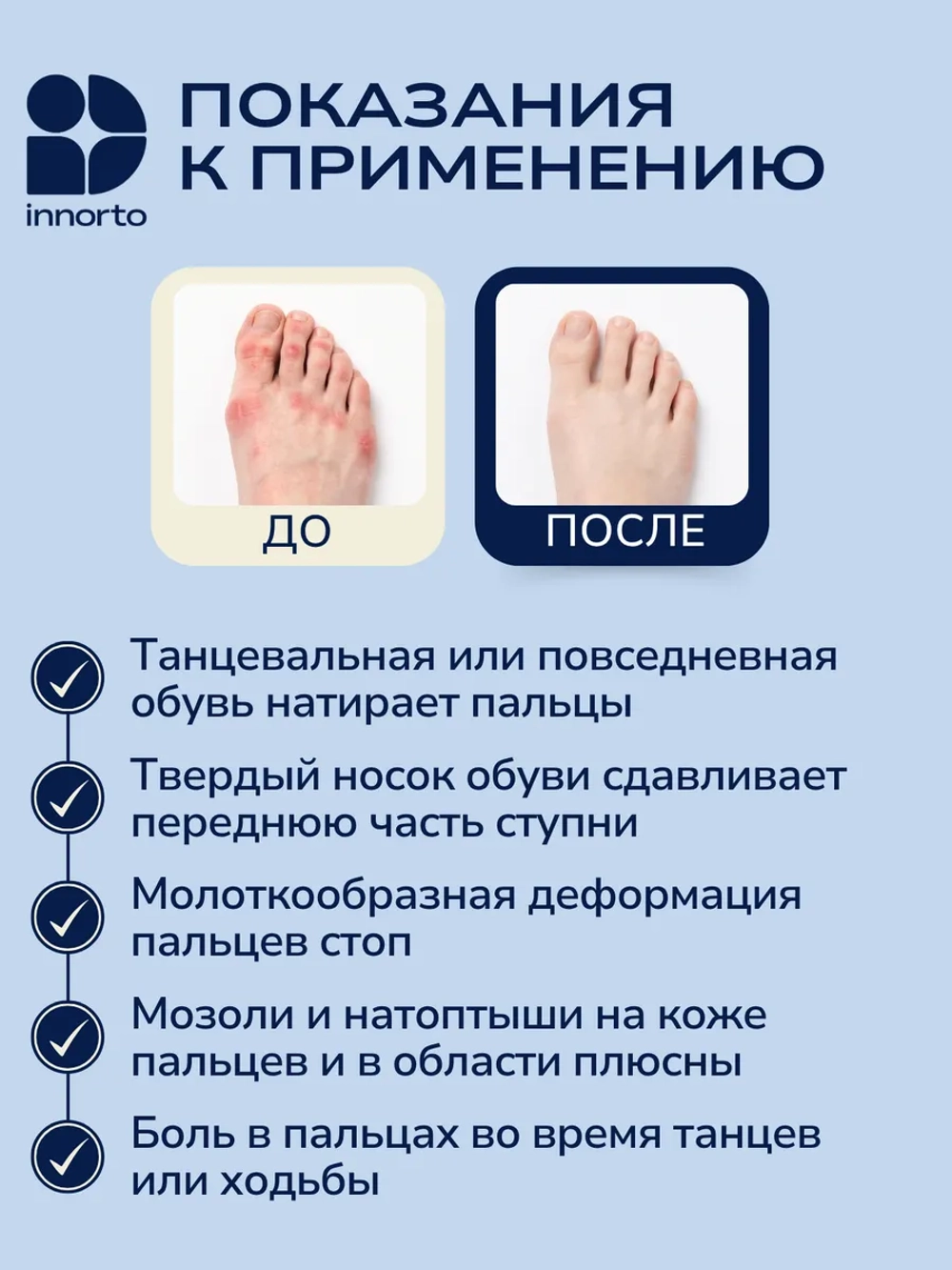 Вкладыши для пуант защита на ноги