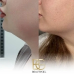 Slim BeautyGel
