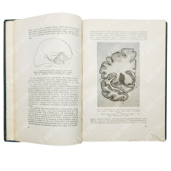 Егоров Б. Г. Проблемы современной нейрохирургии. В 3 томах. М.: Медгиз, 1957