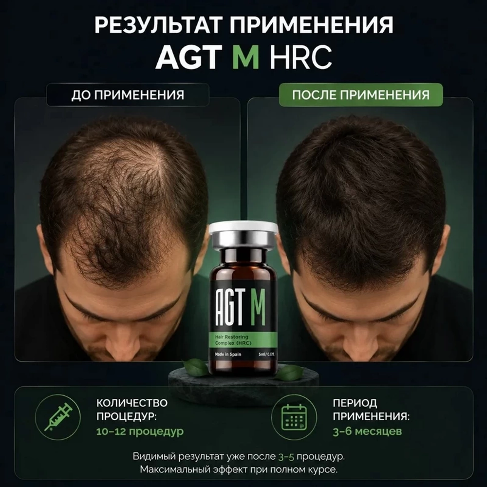 Hair Restoring Complex AGT М
