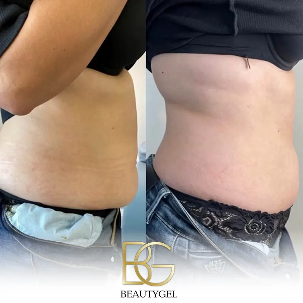 Slim BeautyGel
