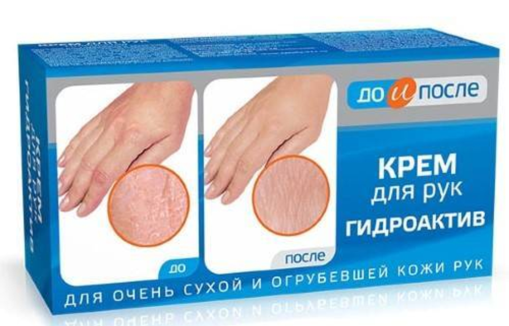 До и После Крем для рук «Гидроактив», 100 мл