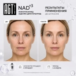 NAD+3 AGT Bio