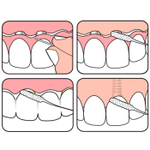 Межзубная нить для мостов и имплантов ТePe Bridge and Implant Floss, 1 уп. (в упаковке 30 нитей), США