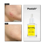 Сыворотка Acnemy PostZit против постакне