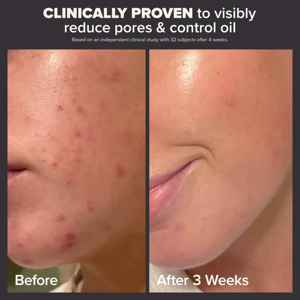 PaulasChoice Skin Perfecting 2% BHA 118mL