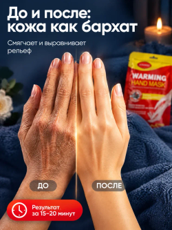 Маска для рук KORMESIC Согревающая, 35 мл
