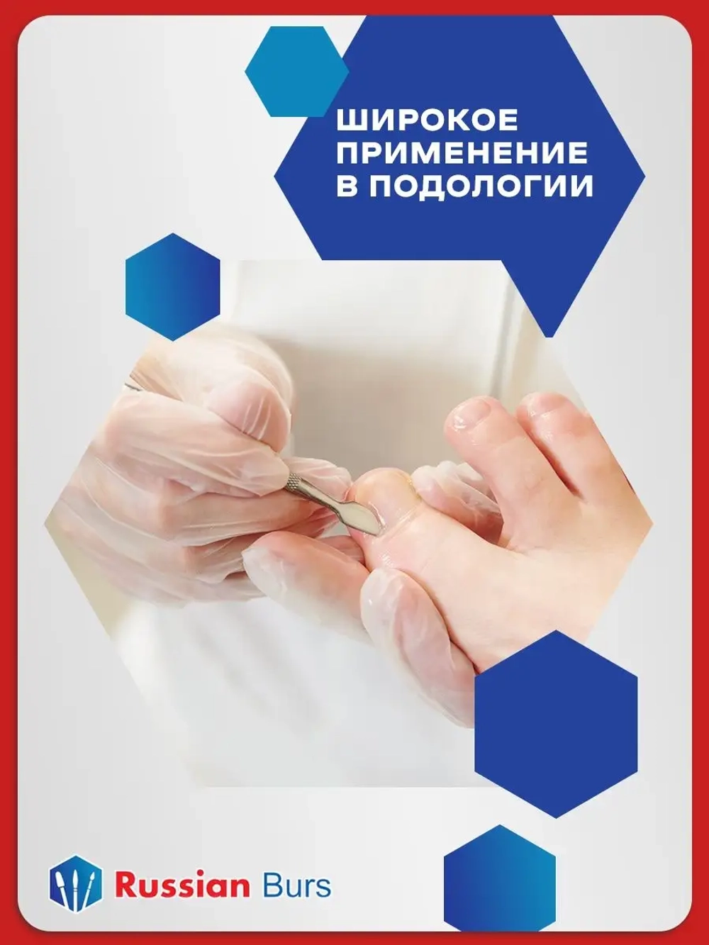 Копалайн набор для тампонады вросшего ногтя