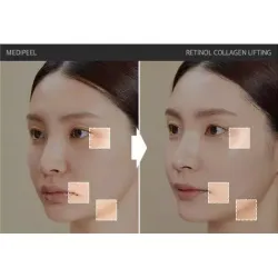 MEDIPEEL Лифтинг-ампула для лица с ретинолом и коллагеном Retinol Collagen Lifting Ampoule (50мл.)