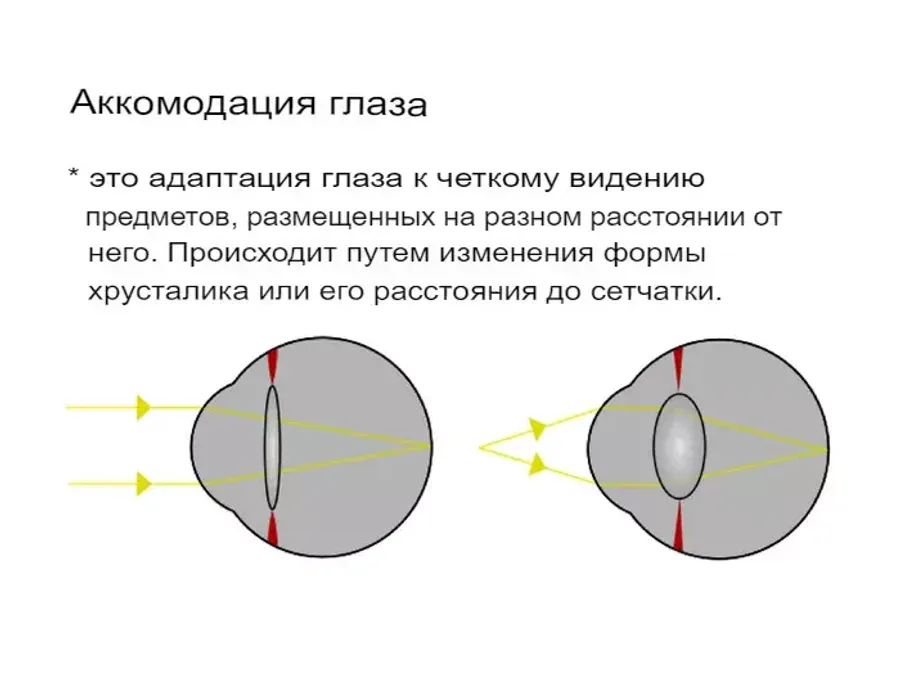 Что такое нарушение аккомодации? Что такое нарушение аккомодации?