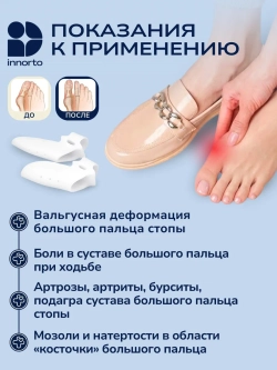 Бурсопротекторы с межпальцевыми разделителями