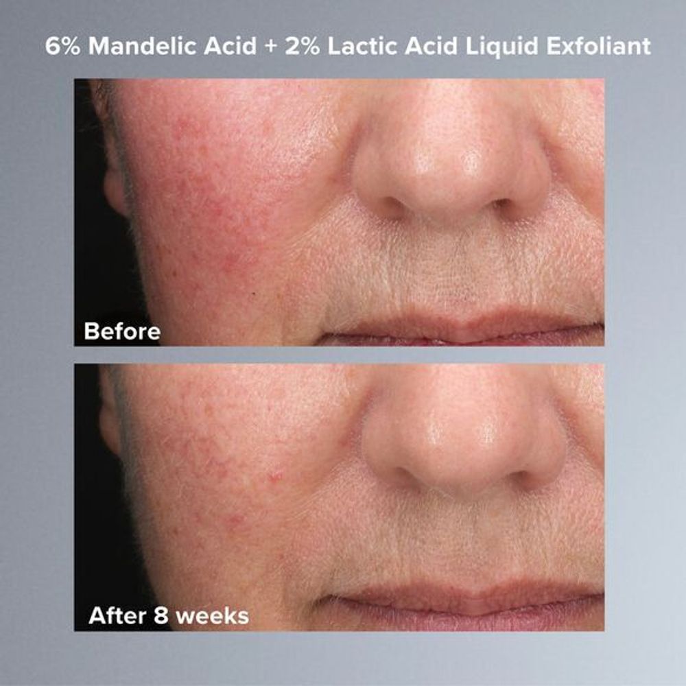 Эксфолиант-тоник Paula's Choice 6% Mandelic Acid + 2% Lactic Acid Liquid Exfoliant 30 мл