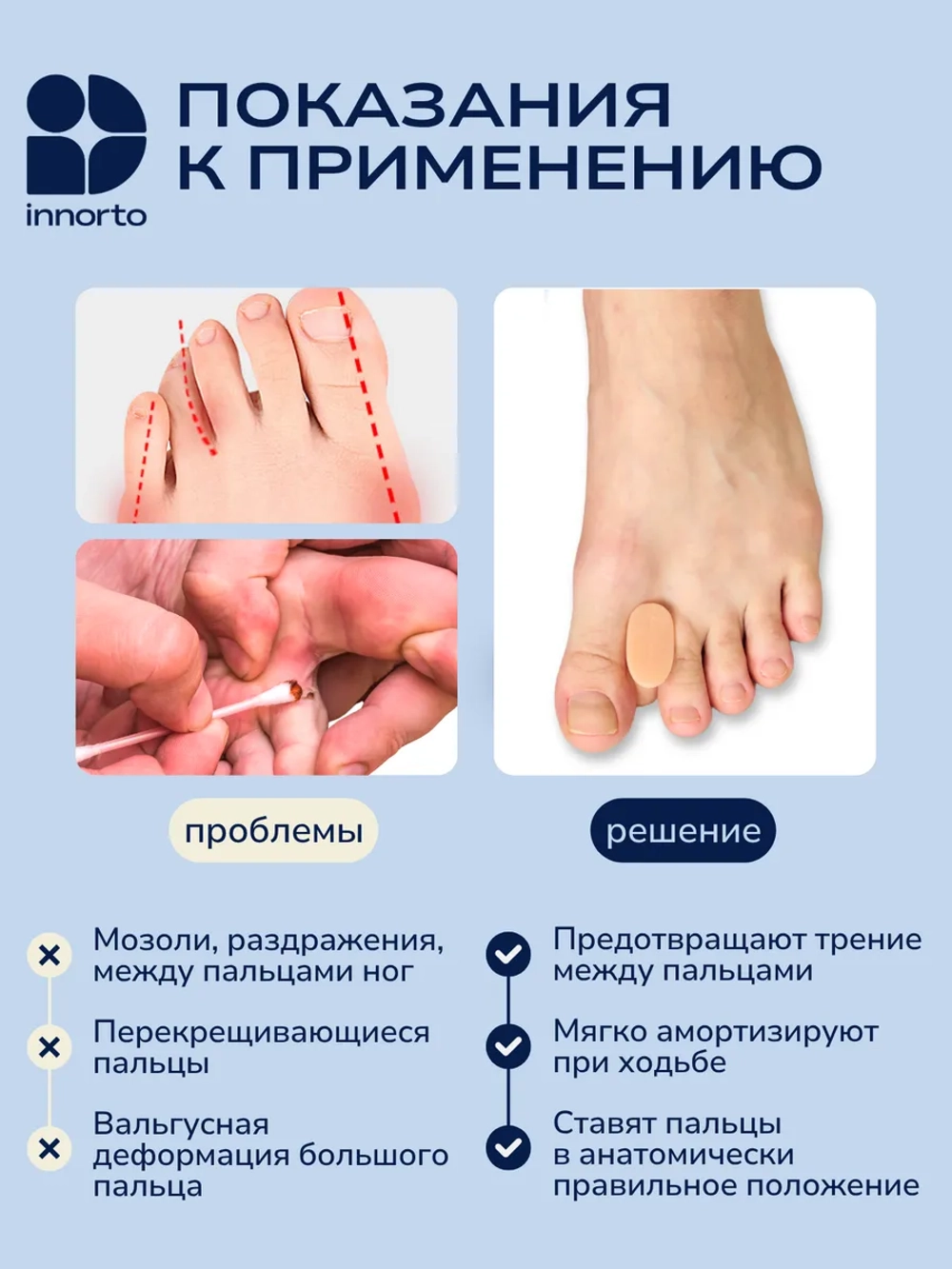 Разделитель для пальцев ног, размер M