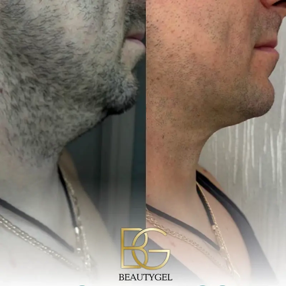Slim BeautyGel