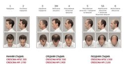 Crescina Transdermic HFSC 100% RE-GROWTH лосьон для возобновления роста волос для мужчин. Дозировка 1300 / 20 ампул по 3,5 мл