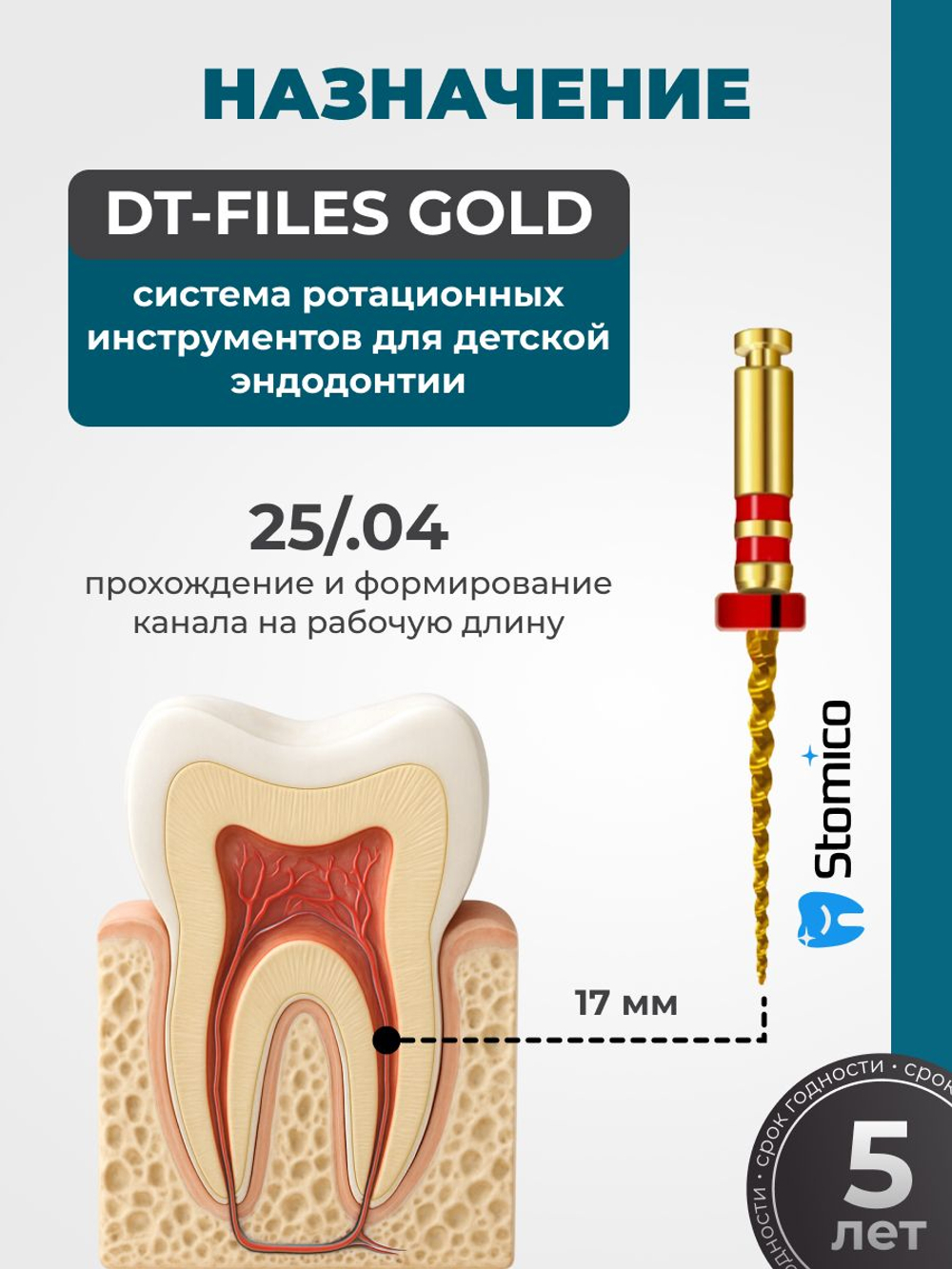 Машинные эндодонтические инструменты STEA DT-Files Gold для детской эндодонтии, 17мм, размер 25/.04