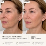 ECQ Veronica | Микроколлаген с усиленной формулой + Эластин + Q10