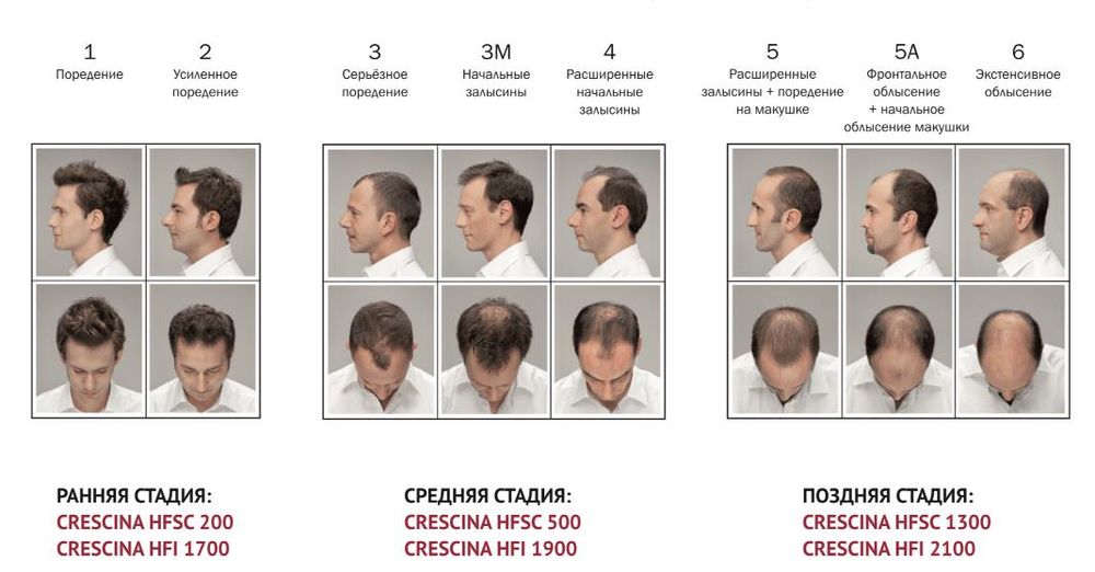Crescina Transdermic HFSC 100% RE-GROWTH лосьон для возобновления роста волос для мужчин. Дозировка 1300 / 20 ампул по 3,5 мл
