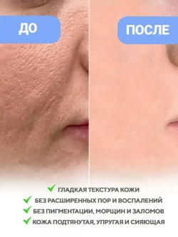VTCOSMETICS REEDLE SHOT 700 Ночная бустер-сыворотка с микроиглами 30 мл