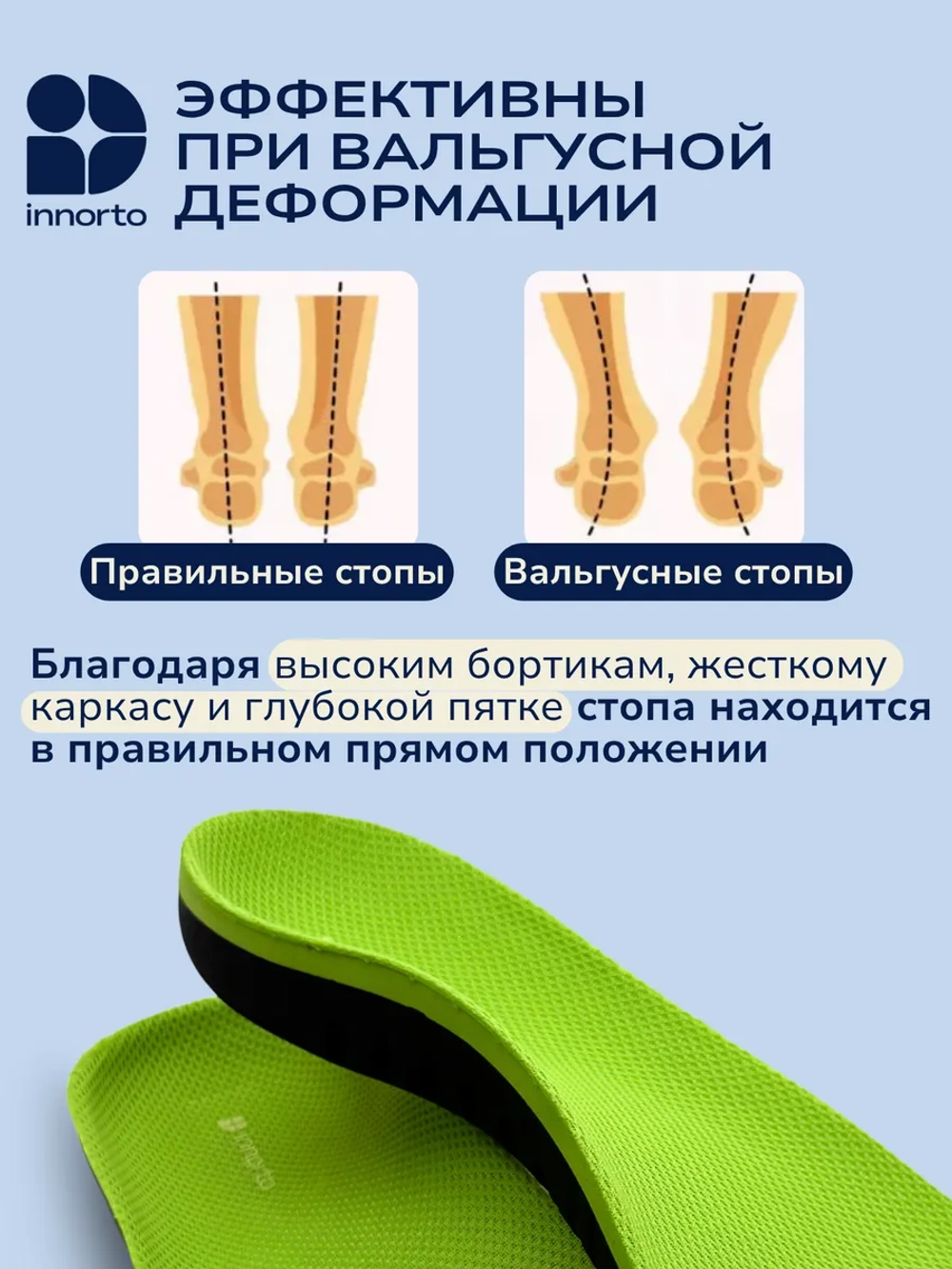 Стельки ортопедические от плоскостопия вальгусные