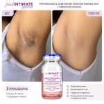 Pink Intimate System