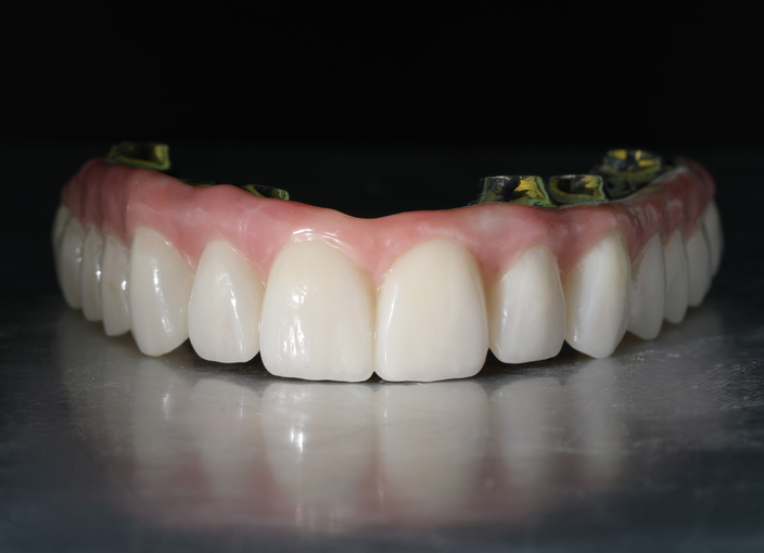 <span class="breadcrumb-page">Протезы на балках (All-on-4 / All-on-6)</span>