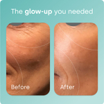Biosil, Advanced Collagen Generator®, добавка для стимуляции выработки коллагена, 30 мл (1 жидк. унция)
